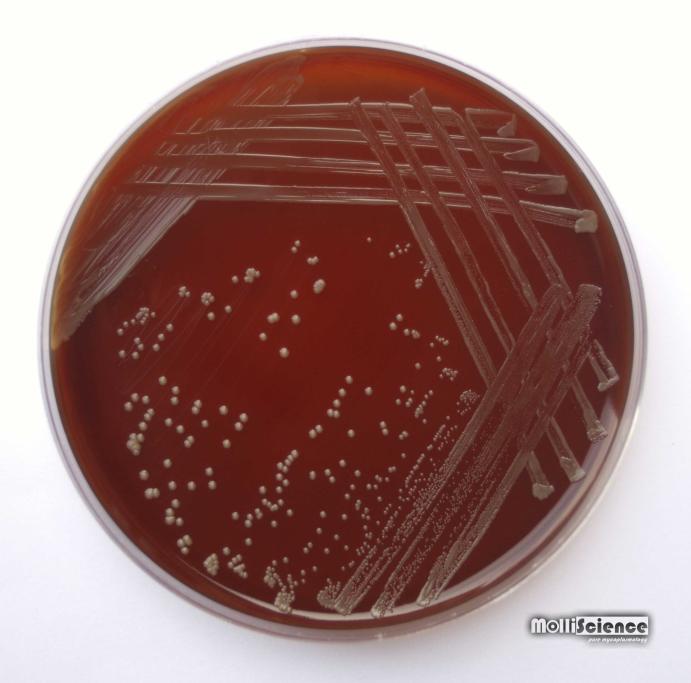 Brucella suis colonies on blooad agar
