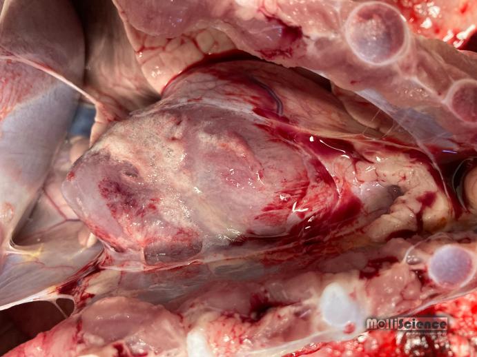 Pericarditis caused by Mycoplasma hyorhinis